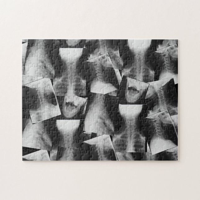 X-Rayed (Original) Jigsaw Puzzle (Horizontal)