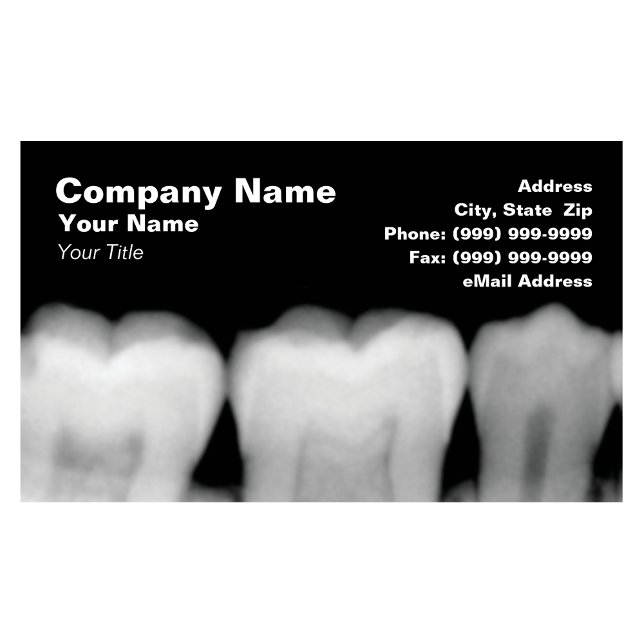 X-Rays of Teeth Business Card (This is a top selling product, and a customer favorite, with repeat orders on a regular basis)