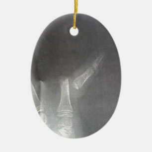 Xray Ceramic Ornament