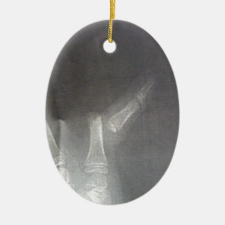 Xray Ceramic Ornament