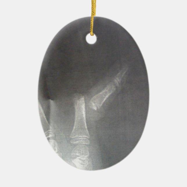 Xray Ceramic Ornament (Front)