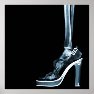 XRAY HIGH HEEL LADY SKELETON FOOT BLUE POSTER