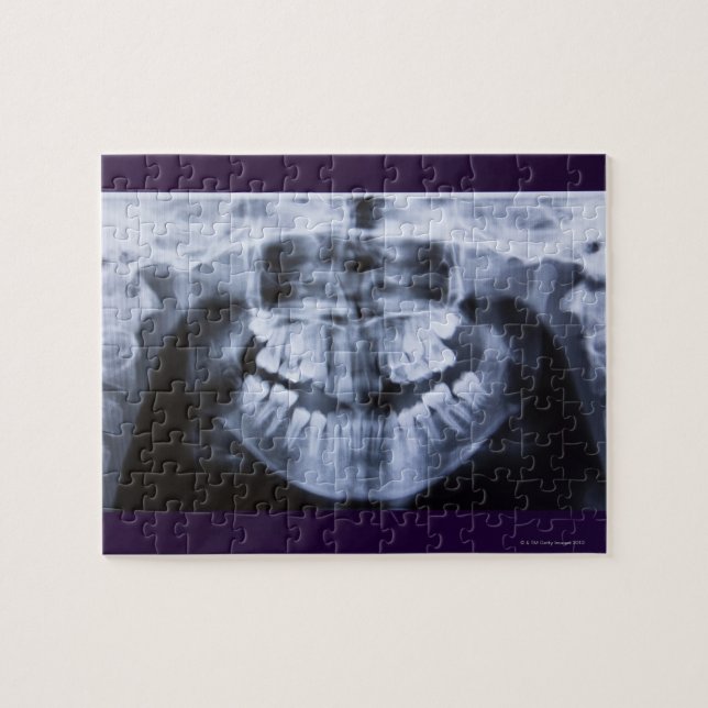 Xray of a girls jawline taken with a panoramic jigsaw puzzle (Horizontal)