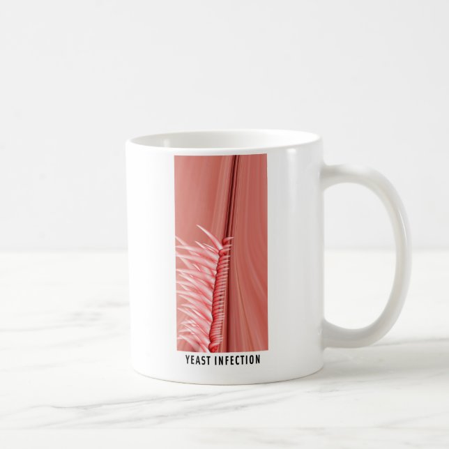 Yeast Infection Coffee Mug (Right)