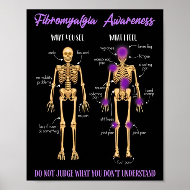 You See What I Feel Skeleton Fibromyalgia Awarenes Poster (Front)