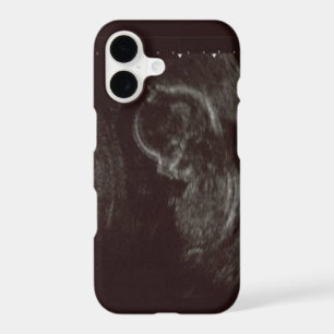 Your Babies Ultrasound Photo